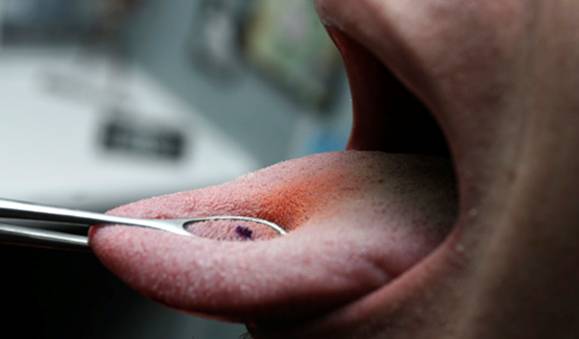 piercing tongue (2)
