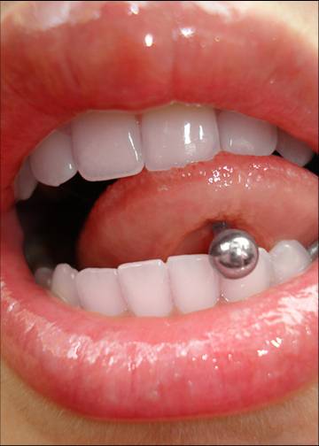 Tongue rings