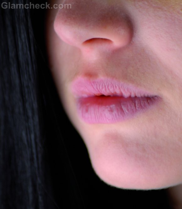 Home Remedies to Deal with Chapped Lips During Summers